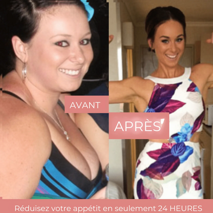 Nuvare GLP-1 Patches